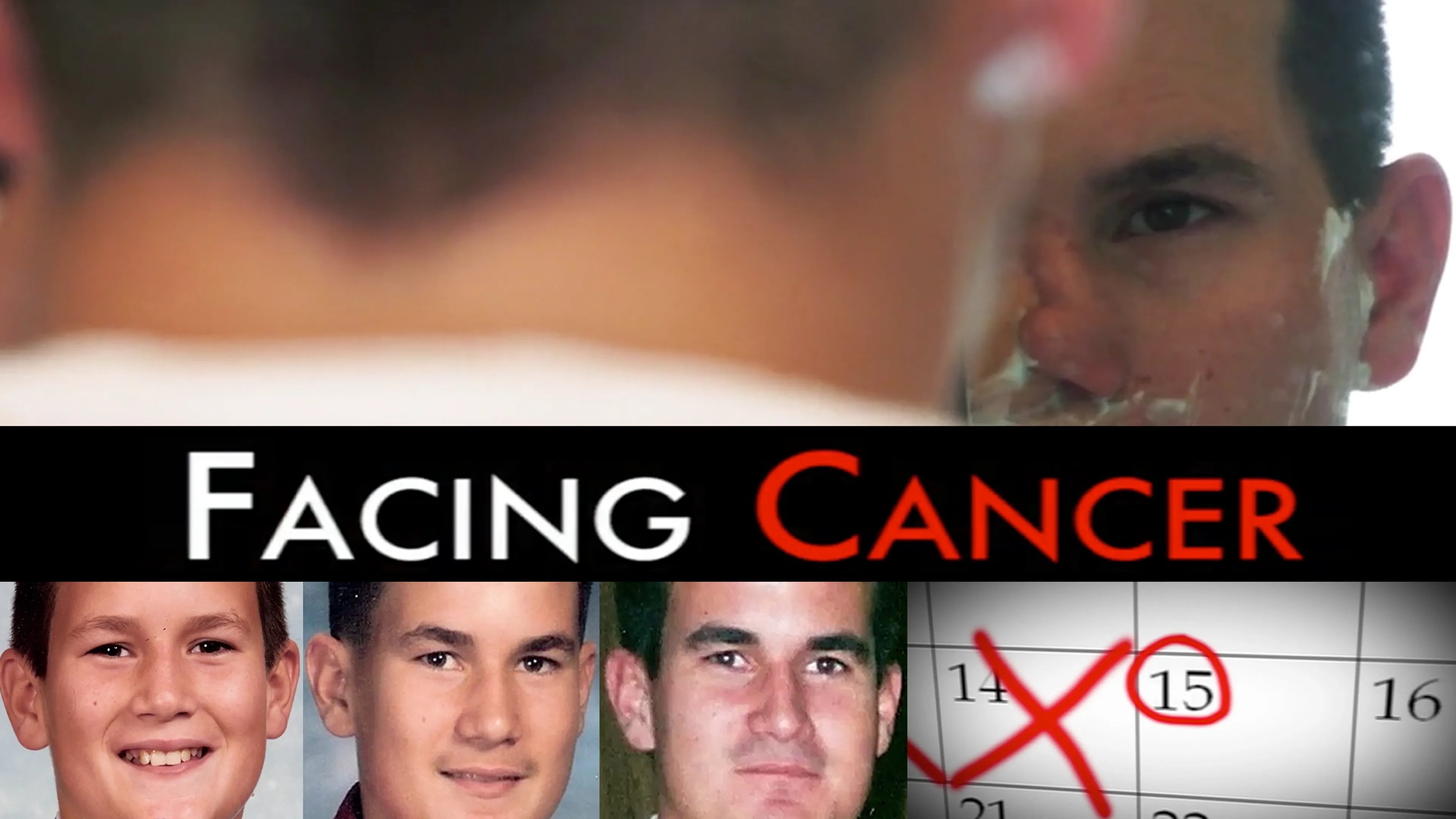 Facing Cancer poster